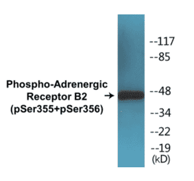 Western Blot - Adrenergic Receptor B2 (phospho Ser355 + Ser356) Cell Based ELISA Kit (CBP1289) - Antibodies.com