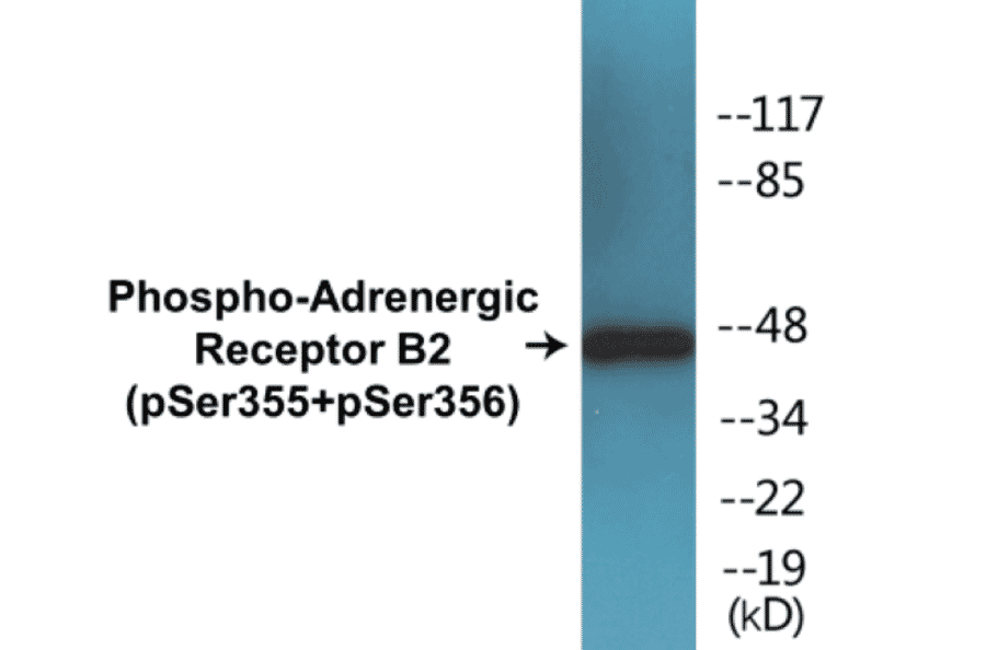 Western Blot - Adrenergic Receptor B2 (phospho Ser355 + Ser356) Cell Based ELISA Kit (CBP1289) - Antibodies.com