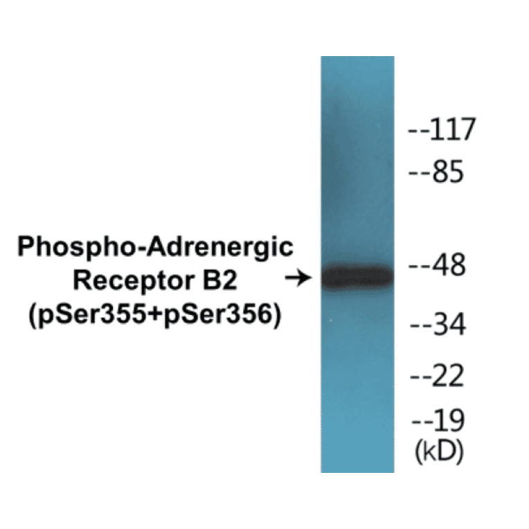 Western Blot - Adrenergic Receptor B2 (phospho Ser355 + Ser356) Cell Based ELISA Kit (CBP1289) - Antibodies.com