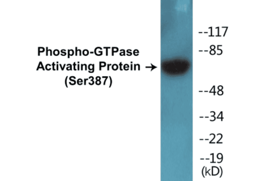 Western Blot - GTPase Activating Protein (phospho Ser387) Cell Based ELISA Kit (CBP1407) - Antibodies.com