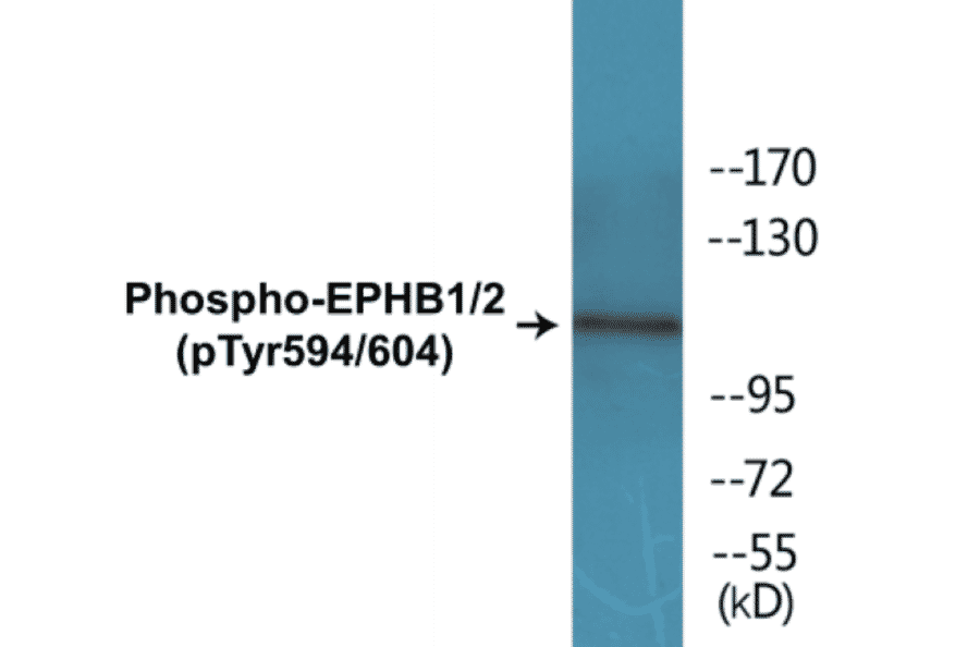 Western Blot - EPHB1 + 2 (phospho Tyr594 + Tyr604) Cell Based ELISA Kit (CBP1366) - Antibodies.com