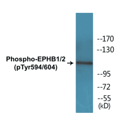 Western Blot - EPHB1 + 2 (phospho Tyr594 + Tyr604) Cell Based ELISA Kit (CBP1366) - Antibodies.com