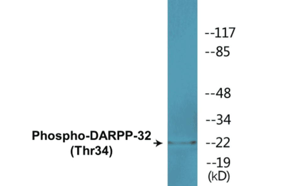 Western Blot - DARPP-32 (phospho Thr34) Cell Based ELISA Kit (CBP1528) - Antibodies.com