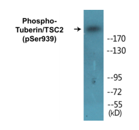 Western Blot - Tuberin (phospho Ser939) Cell Based ELISA Kit (CBP1227) - Antibodies.com