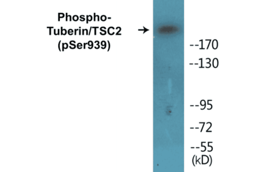 Western Blot - Tuberin (phospho Ser939) Cell Based ELISA Kit (CBP1227) - Antibodies.com