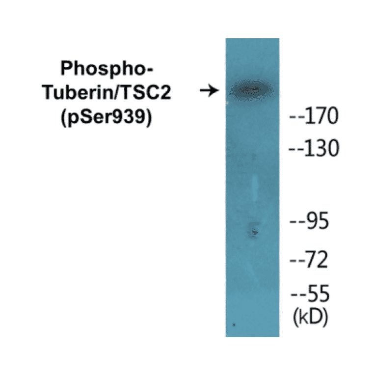 Western Blot - Tuberin (phospho Ser939) Cell Based ELISA Kit (CBP1227) - Antibodies.com