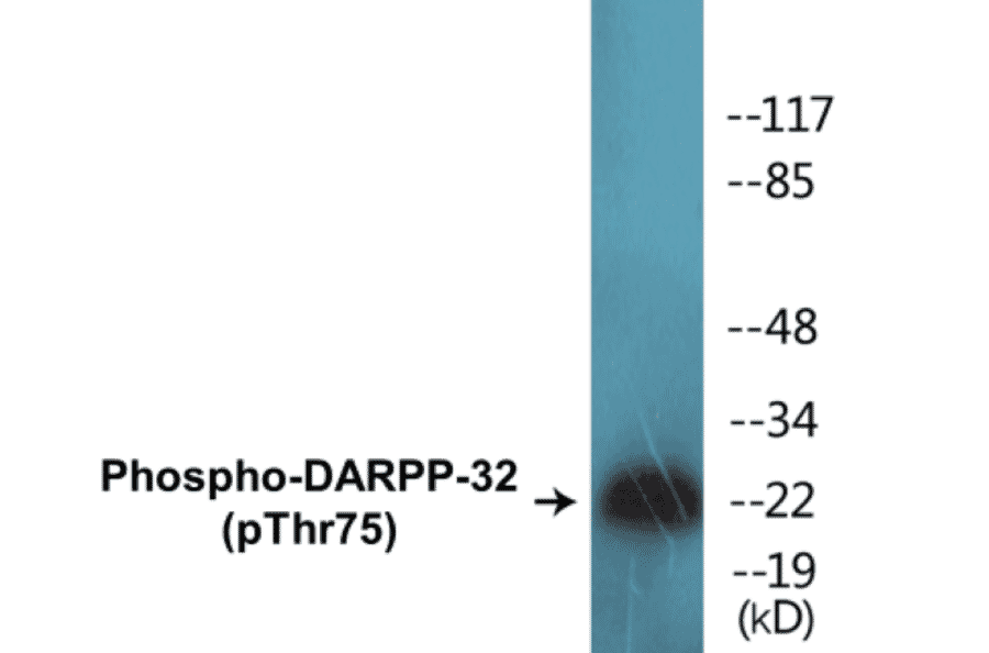 Western Blot - DARPP-32 (phospho Thr75) Cell Based ELISA Kit (CBP1007) - Antibodies.com