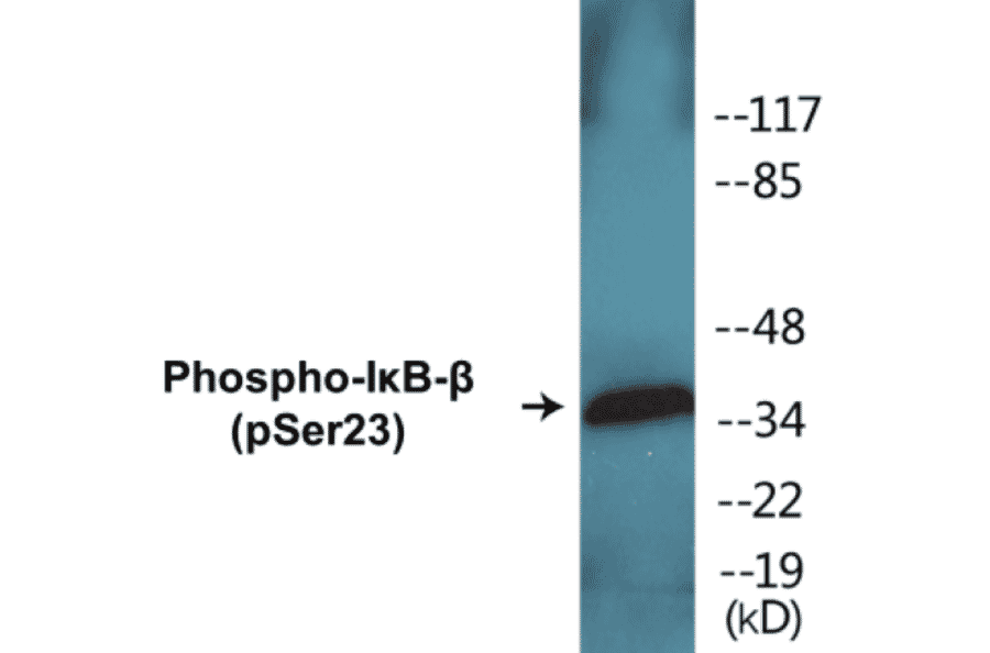 Western Blot - IkB beta (phospho Ser23) Cell Based ELISA Kit (CBP1014) - Antibodies.com
