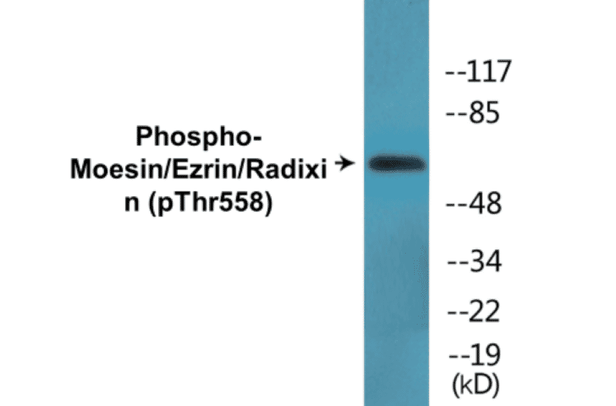 Western Blot - Radixin (phospho Thr558) Cell Based ELISA Kit (CBP1434) - Antibodies.com