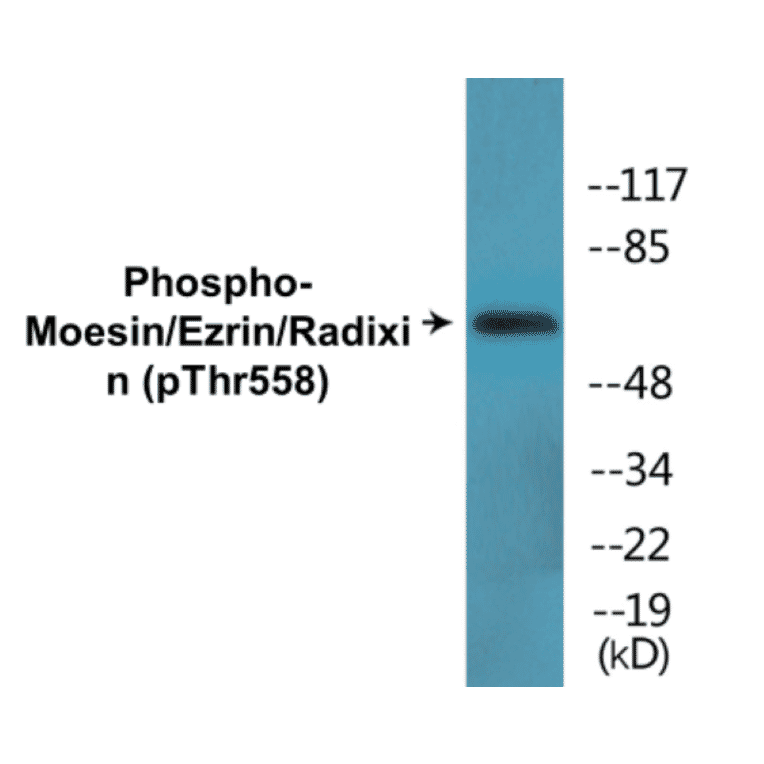 Western Blot - Radixin (phospho Thr558) Cell Based ELISA Kit (CBP1434) - Antibodies.com