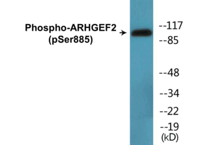 Western Blot - ARHGEF2 (phospho Ser885) Cell Based ELISA Kit (CBP1478) - Antibodies.com