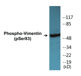 Western Blot - Vimentin (phospho Ser83) Cell Based ELISA Kit (CBP1484) - Antibodies.com