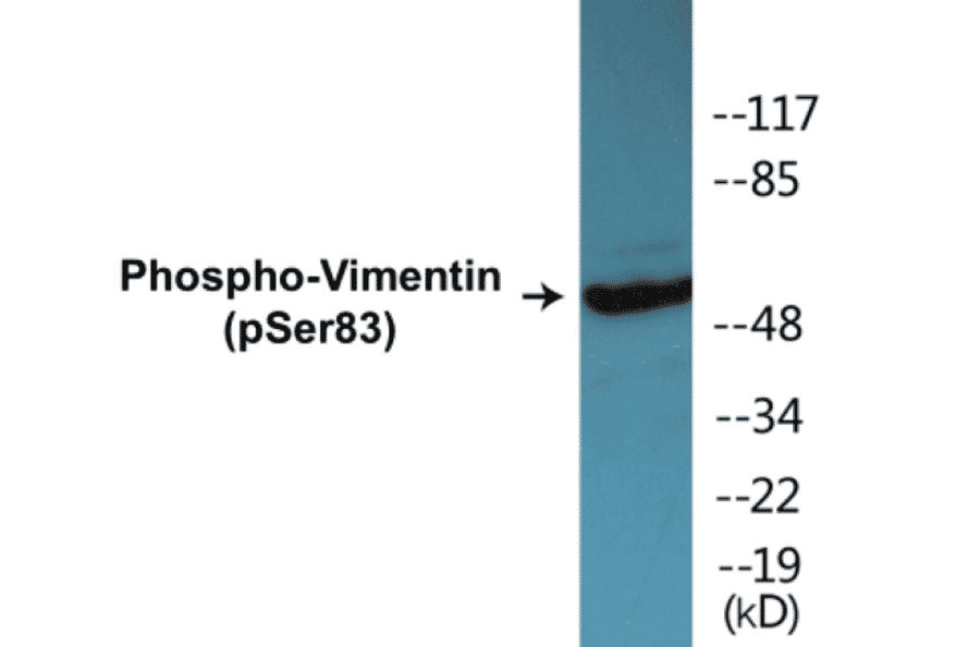 Western Blot - Vimentin (phospho Ser83) Cell Based ELISA Kit (CBP1484) - Antibodies.com