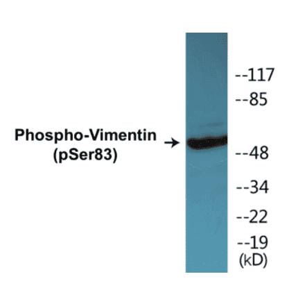 Western Blot - Vimentin (phospho Ser83) Cell Based ELISA Kit (CBP1484) - Antibodies.com