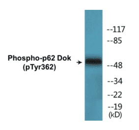 Western Blot - p62 Dok (phospho Tyr362) Cell Based ELISA Kit (CBP1529) - Antibodies.com