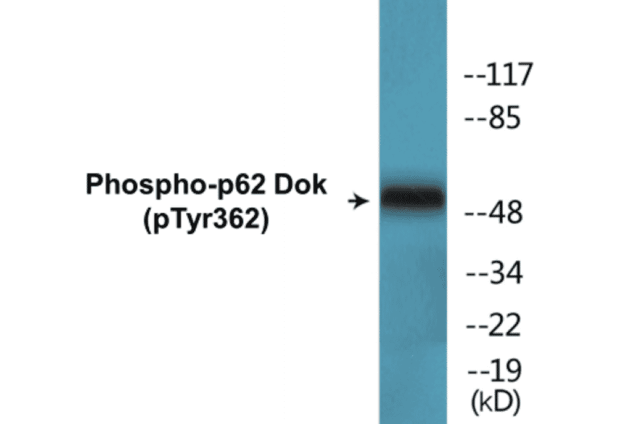 Western Blot - p62 Dok (phospho Tyr362) Cell Based ELISA Kit (CBP1529) - Antibodies.com