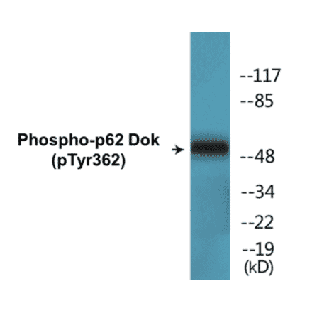 Western Blot - p62 Dok (phospho Tyr362) Cell Based ELISA Kit (CBP1529) - Antibodies.com