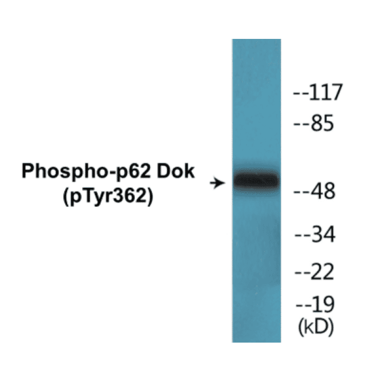 Western Blot - p62 Dok (phospho Tyr362) Cell Based ELISA Kit (CBP1529) - Antibodies.com