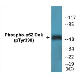 Western Blot - p62 Dok (phospho Tyr398) Cell Based ELISA Kit (CBP1530) - Antibodies.com