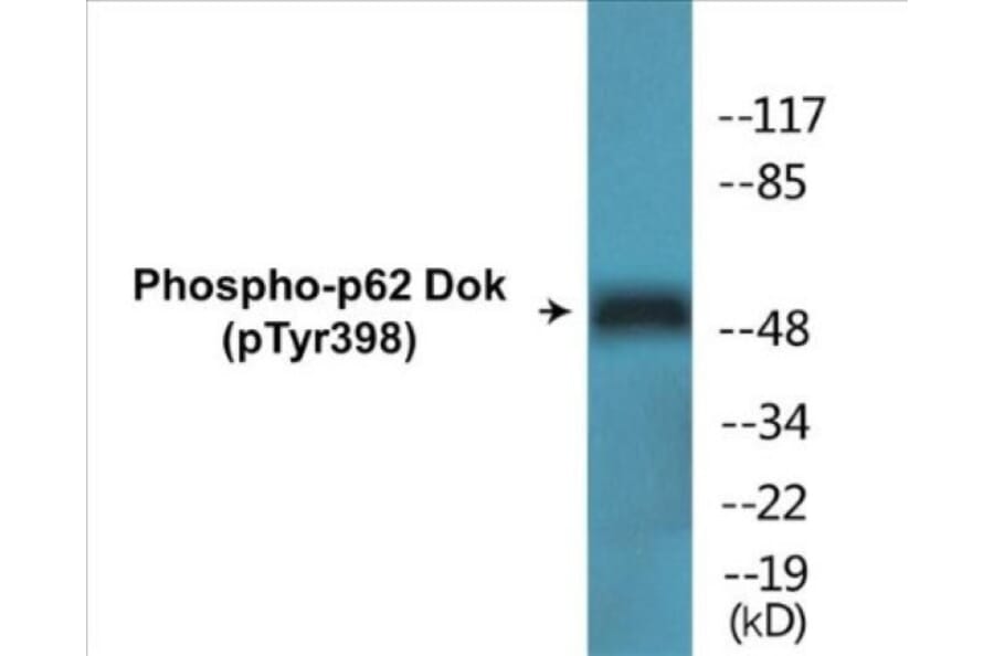 Western Blot - p62 Dok (phospho Tyr398) Cell Based ELISA Kit (CBP1530) - Antibodies.com