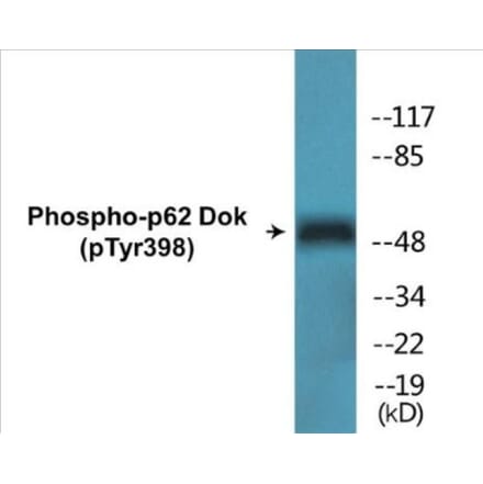 Western Blot - p62 Dok (phospho Tyr398) Cell Based ELISA Kit (CBP1530) - Antibodies.com