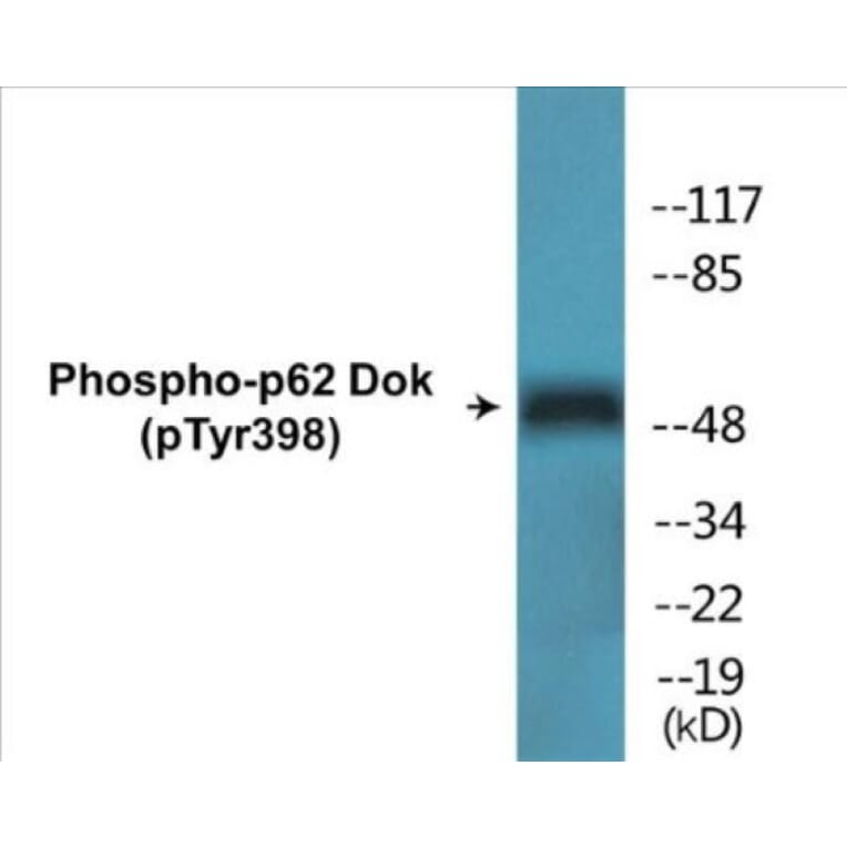 Western Blot - p62 Dok (phospho Tyr398) Cell Based ELISA Kit (CBP1530) - Antibodies.com