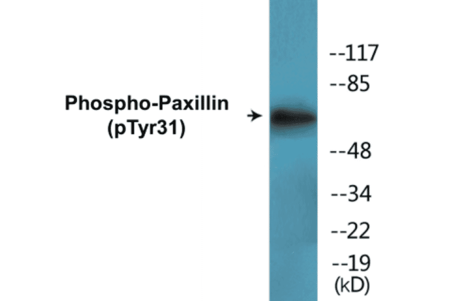 Western Blot - Paxillin (phospho Tyr31) Cell Based ELISA Kit (CBP1655) - Antibodies.com