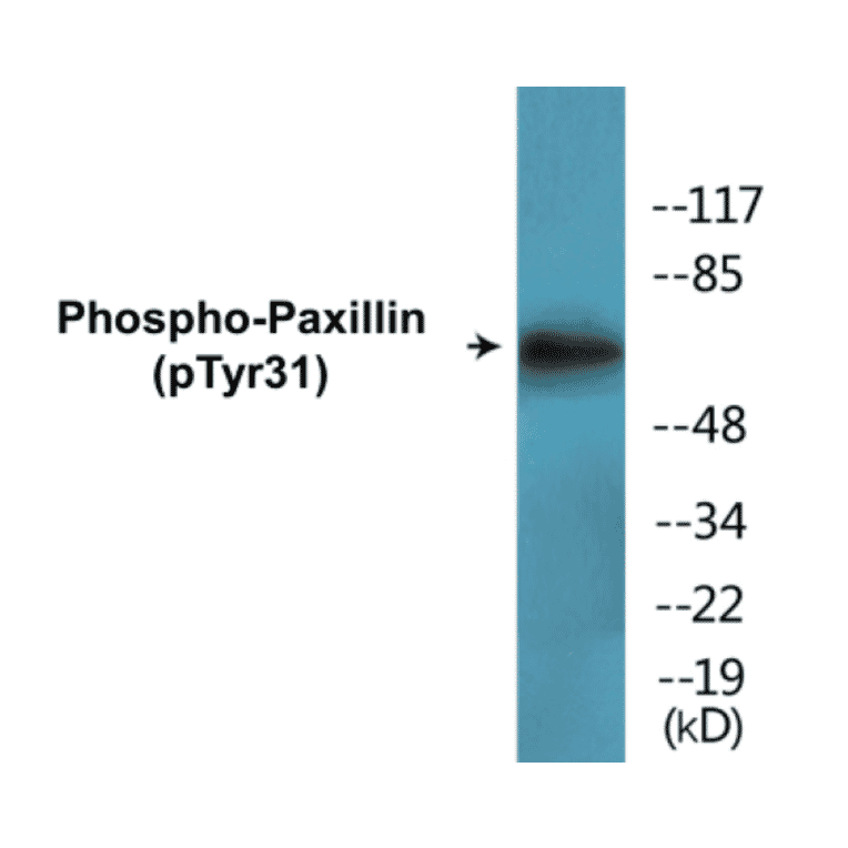 Western Blot - Paxillin (phospho Tyr31) Cell Based ELISA Kit (CBP1655) - Antibodies.com