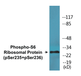 Western Blot - S6 Ribosomal Protein (phospho Ser235 + Ser236) Cell Based ELISA Kit (CBP1838) - Antibodies.com