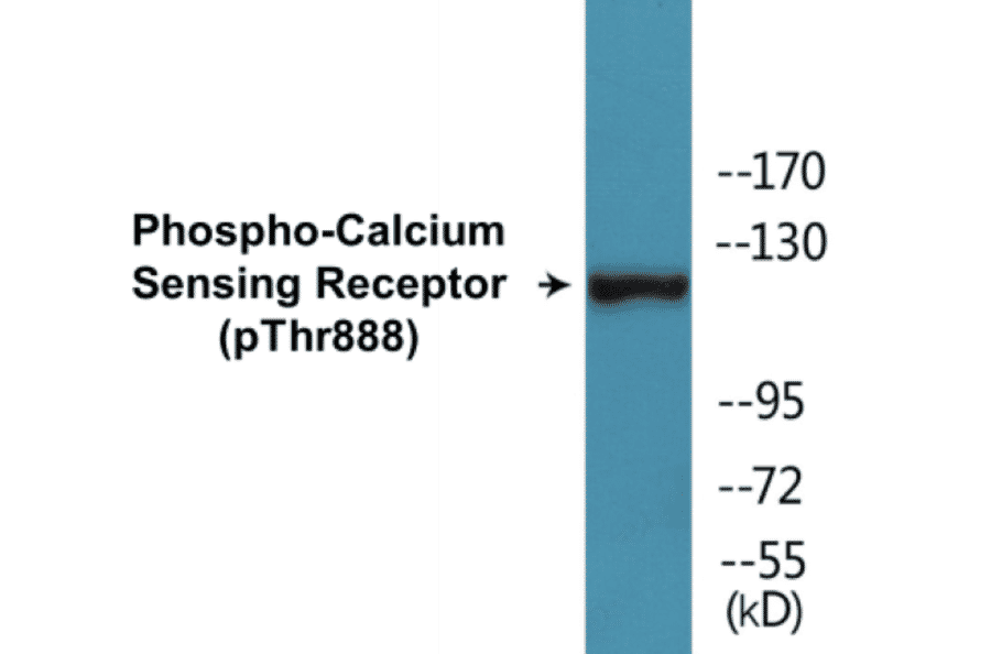 Western Blot - Calcium Sensing Receptor (phospho Thr888) Cell Based ELISA Kit (CBP1326) - Antibodies.com