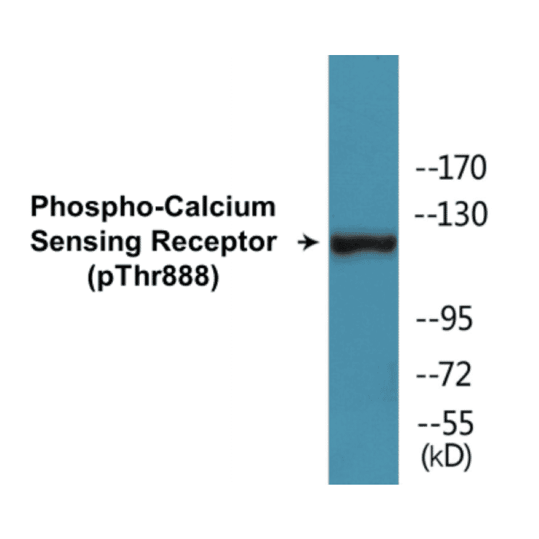 Western Blot - Calcium Sensing Receptor (phospho Thr888) Cell Based ELISA Kit (CBP1326) - Antibodies.com