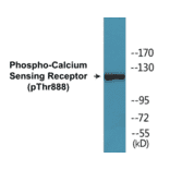 Western Blot - Calcium Sensing Receptor (phospho Thr888) Cell Based ELISA Kit (CBP1326) - Antibodies.com