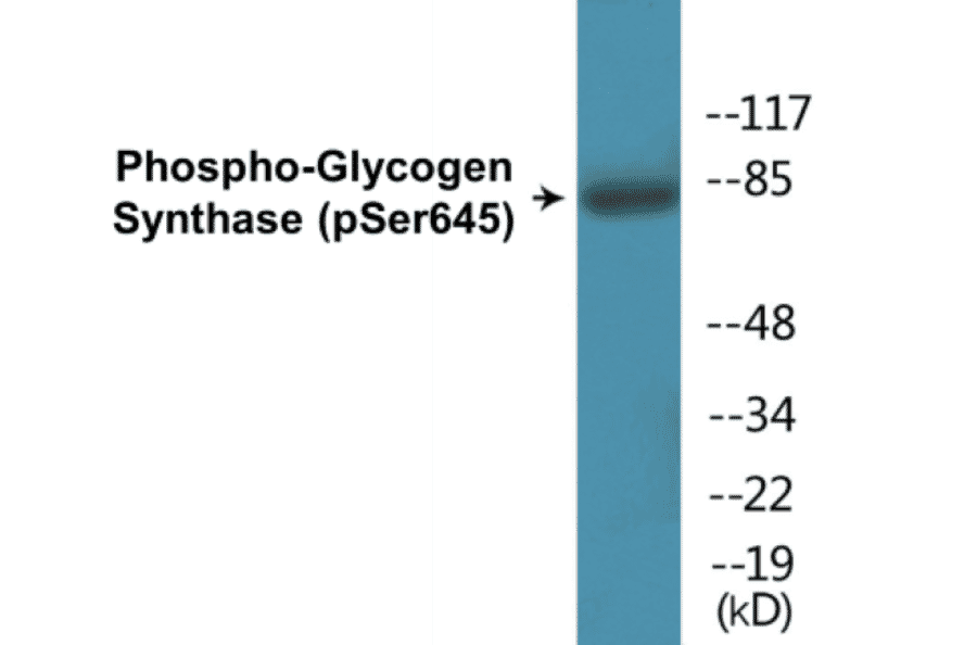 Western Blot - Glycogen Synthase (phospho Ser645) Cell Based ELISA Kit (CBP1119) - Antibodies.com