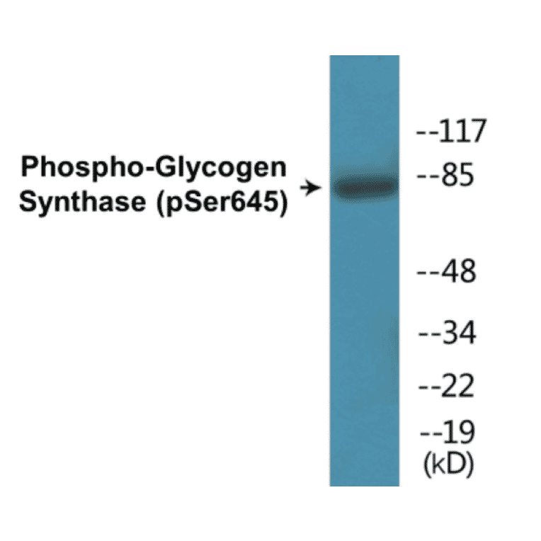 Western Blot - Glycogen Synthase (phospho Ser645) Cell Based ELISA Kit (CBP1119) - Antibodies.com