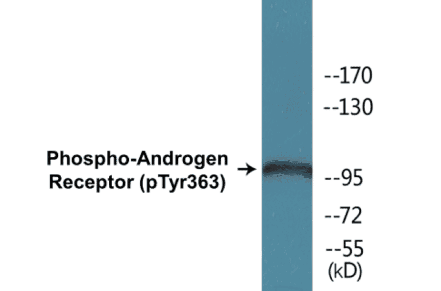 Western Blot - Androgen Receptor (phospho Tyr363) Cell Based ELISA Kit (CBP1777) - Antibodies.com