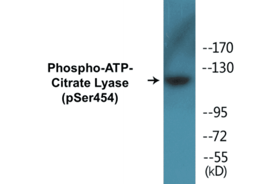 Western Blot - ATP-Citrate Lyase (phospho Ser454) Cell Based ELISA Kit (CBP1243) - Antibodies.com