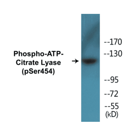 Western Blot - ATP-Citrate Lyase (phospho Ser454) Cell Based ELISA Kit (CBP1243) - Antibodies.com