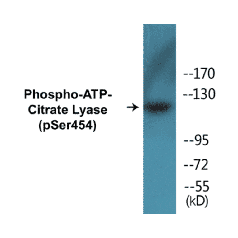 Western Blot - ATP-Citrate Lyase (phospho Ser454) Cell Based ELISA Kit (CBP1243) - Antibodies.com