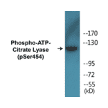 Western Blot - ATP-Citrate Lyase (phospho Ser454) Cell Based ELISA Kit (CBP1243) - Antibodies.com