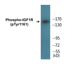 Western Blot - IGF1R (phospho Tyr1161) Cell Based ELISA Kit (CBP1040) - Antibodies.com