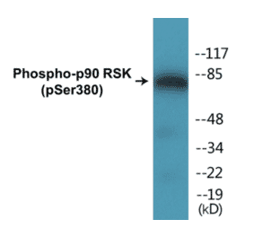 Western Blot - p90RSK (phospho Ser380) Cell Based ELISA Kit (CBP1194) - Antibodies.com