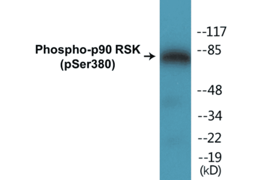 Western Blot - p90RSK (phospho Ser380) Cell Based ELISA Kit (CBP1194) - Antibodies.com