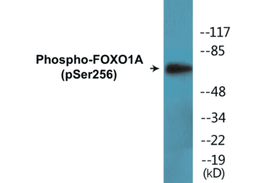 Western Blot - FOXO1A (phospho Ser256) Cell Based ELISA Kit (CBP1556) - Antibodies.com