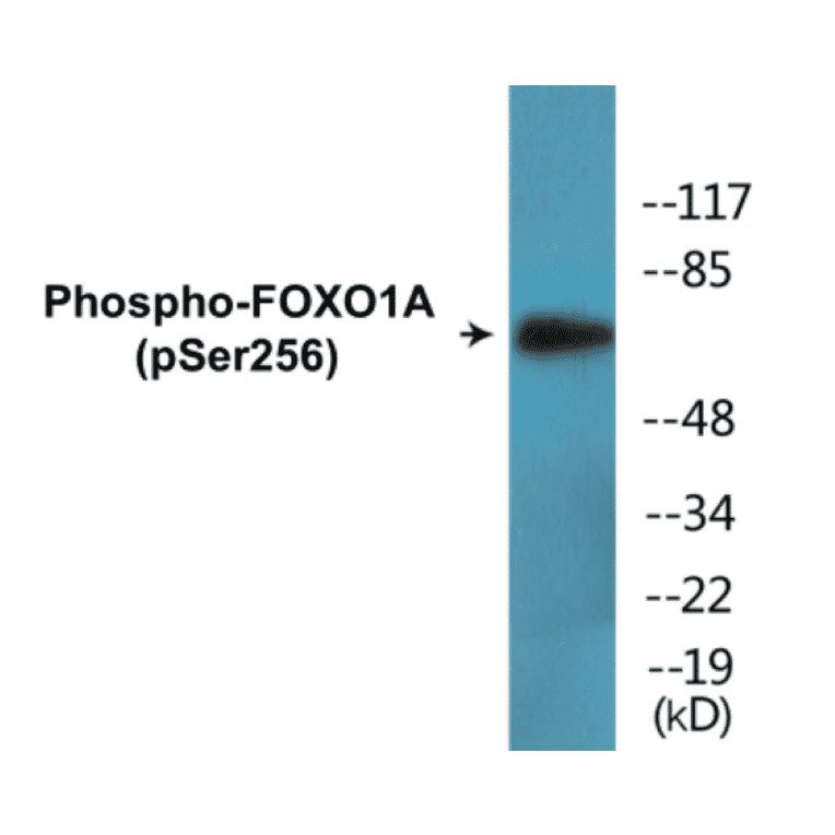Western Blot - FOXO1A (phospho Ser256) Cell Based ELISA Kit (CBP1556) - Antibodies.com