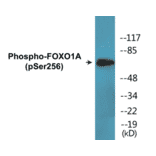 Western Blot - FOXO1A (phospho Ser256) Cell Based ELISA Kit (CBP1556) - Antibodies.com