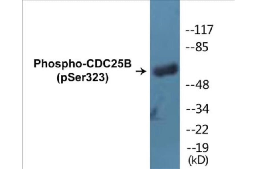 Western Blot - CDC25B (phospho Ser323) Cell Based ELISA Kit (CBP1056) - Antibodies.com