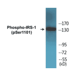 Western Blot - IRS-1 (phospho Ser1101) Cell Based ELISA Kit (CBP1132) - Antibodies.com