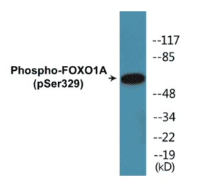 Western Blot - FOXO1A (phospho Ser329) Cell Based ELISA Kit (CBP1159) - Antibodies.com