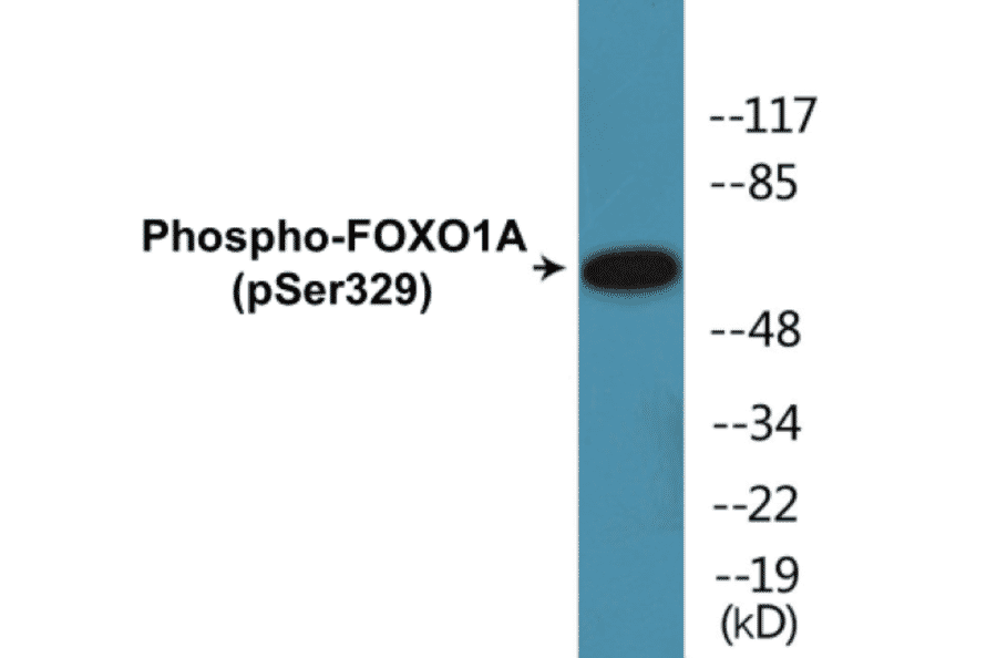 Western Blot - FOXO1A (phospho Ser329) Cell Based ELISA Kit (CBP1159) - Antibodies.com