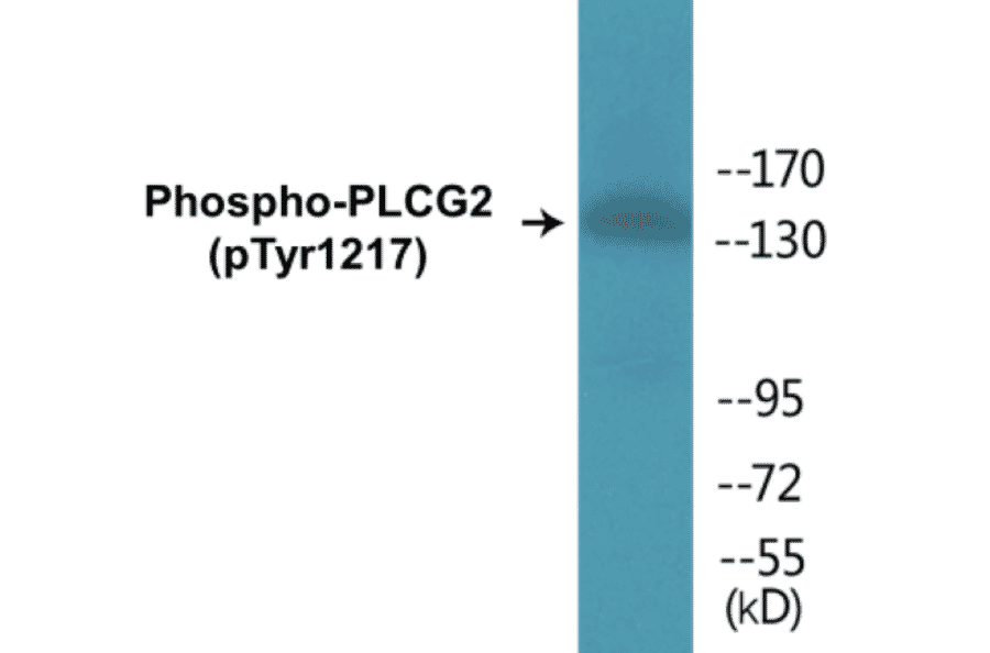 Western Blot - PLCG2 (phospho Tyr1217) Cell Based ELISA Kit (CBP1203) - Antibodies.com